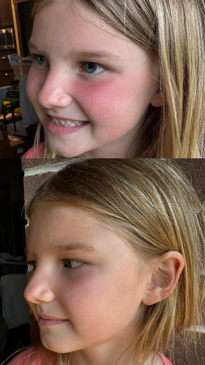 Tallow Sunshine Recovery